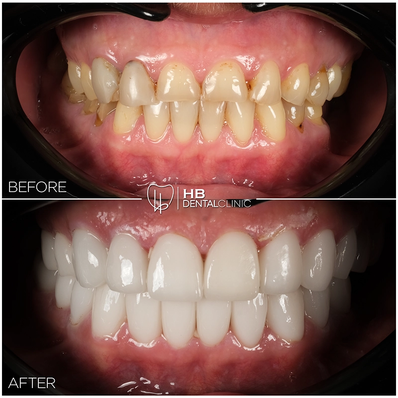 Healthy Beautiful Smile