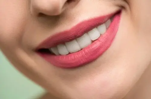 Hollywood Smile